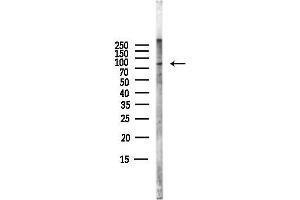 anti-WEE1 Homolog (S. Pombe) (WEE1) (pSer123) antibody