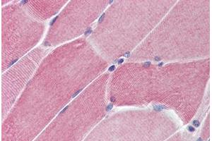 Human Skeletal Muscle (formalin-fixed, paraffin-embedded) stained with PTPN11 antibody ABIN214466 at 5 ug/ml followed by biotinylated goat anti-rabbit IgG secondary antibody ABIN481713, alkaline phosphatase-streptavidin and chromogen. (PTPN11 antibody  (N-Term))