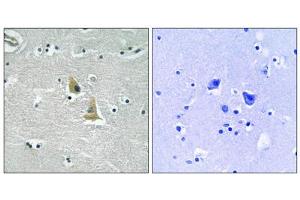 Immunohistochemistry analysis of paraffin-embedded human brain tissue, using p47 phox (epitope around residue 345) antibody. (NCF1 antibody  (Ser345))