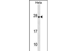 ZT4 Antibody (N-term) (ABIN1538915 and ABIN2849800) western blot analysis in Hela cell line lysates (35 μg/lane). (ZMAT4 antibody  (N-Term))