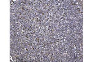 IHC analysis of SCA2/ATXN2 using anti-SCA2/ATXN2 antibody (ABIN7599900). (Ataxin 2 antibody  (AA 1278-1313))