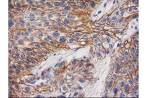 Image no. 1 for anti-Catenin (Cadherin-Associated Protein), beta 1, 88kDa (CTNNB1) antibody (ABIN1496894) (CTNNB1 antibody)