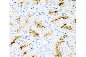 Immunohistochemistry of paraffin-embedded Rat kidney using IL17A Polyclonal Antibody at dilution of 1:100 (40x lens). (Interleukin 17a antibody)