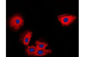 Immunofluorescent analysis of TIMP2 staining in MCF7 cells. (TIMP2 antibody  (Center))