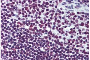 Human Tonsil: Formalin-Fixed, Paraffin-Embedded (FFPE) (EWSR1 antibody  (AA 358-454))