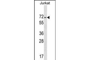 ZN Antibody (C-term) (ABIN1537425 and ABIN2849297) western blot analysis in Jurkat cell line lysates (35 μg/lane).