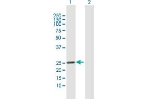 Western Blot analysis of GSTK1 expression in transfected 293T cell line by GSTK1 MaxPab polyclonal antibody. (GSTK1 antibody  (AA 1-226))