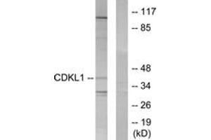 Western blot analysis of extracts from COLO205 cells, using CDKL1 Antibody. (CDKL1 antibody  (AA 281-330))