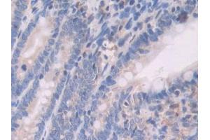 Used in DAB staining on fromalin fixed paraffin- embedded pancreas tissue (UCP1 antibody  (AA 179-296))