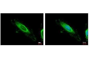 ICC/IF Image TBRG4 antibody detects TBRG4 protein at mitochondria by immunofluorescent analysis. (TBRG4 antibody)