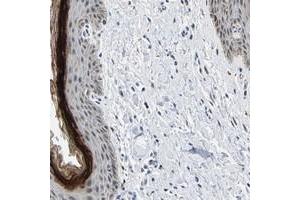 Immunohistochemical staining of human vulva/anal skin with C14orf177 polyclonal antibody  shows distinct positivity in stratum granulosum of squamous epithelium. (C14ORF177 antibody)