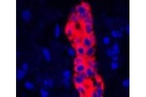 Immunofluorescence analysis of Human liver tissue using CK-19 Polyclonal Antibody at dilution of 1:200. (Cytokeratin 19 antibody)
