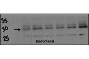 Western blot testing of DSCR1 antibody (1:500) and endothelial cell lysate. (RCAN1 antibody  (AA 75-104))