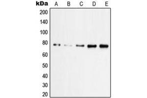 Western blot analysis of PKC zeta (pT560) expression in HeLa UV-treated (A), A431 (B), A549 UV-treated (C), SP2/0 UV-treated (D), PC12 UV-treated (E) whole cell lysates. (PKC zeta antibody  (C-Term, pSer560))
