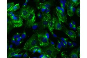 Immunofluorescence (IF) image for anti-Protein Kinase, CAMP-Dependent, Regulatory, Type II, beta (PRKAR2B) (pSer114) antibody (ABIN968875) (PRKAR2B antibody  (pSer114))
