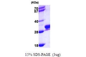 SDS-PAGE (SDS) image for RAB27B, Member RAS Oncogene Family (RAB27B) (AA 1-218) protein (His tag) (ABIN667319) (RAB27B Protein (AA 1-218) (His tag))