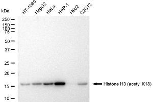 Western blotting analysis using Histone H3 (acetyl K18) antibody (ABIN7798970). (Recombinant Histone 3 antibody  (H3K18ac))