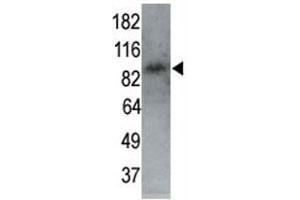 MARK1 antibody used in western blot to detect MARK1 in P7 mouse whole brain lysate (60 ug) at 1:250. (MARK1 antibody  (AA 6-40))