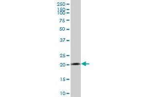 RPS7 polyclonal antibody (A01), Lot # 051213JC01 Western Blot analysis of RPS7 expression in MCF-7 .