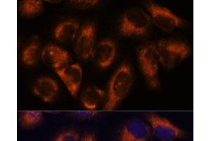 Immunofluorescence analysis of HeLa cells using NDRG4 Polyclonal Antibody at dilution of 1:100. (NDRG4 antibody)