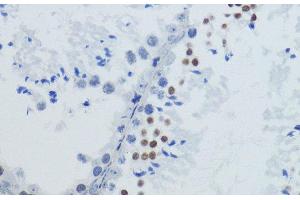 Immunohistochemistry of paraffin-embedded Mouse testis using Acetyl-Histone H4-K12 Polyclonal Antibody at dilution of 1:200 (40x lens). (Histone H4 antibody  (acLys12))