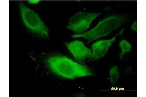 Immunofluorescence of monoclonal antibody to TSSC1 on HeLa cell.