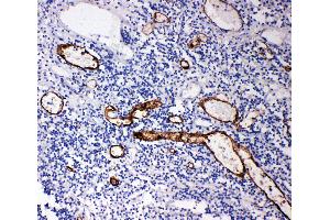 Anti-MAdCAM1 antibody, IHC(P) IHC(P): Human Appendicitis Tissue (MADCAM1 antibody  (Middle Region))