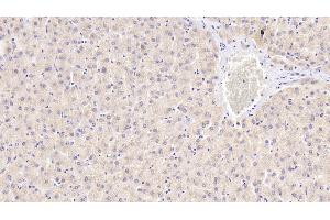 Detection of ENDOG in Human Liver Tissue using Polyclonal Antibody to Endonuclease G, Mitochondrial (ENDOG) (Endonuclease G antibody  (AA 16-290))