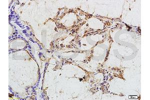 Immunohistochemistry (IHC) image for anti-Carcinoembryonic Antigen Gene Family (CEA) antibody (ABIN722931) (CEA antibody)