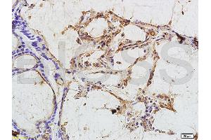 Immunohistochemistry (IHC) image for anti-Carcinoembryonic Antigen Gene Family (CEA) antibody (ABIN722931)