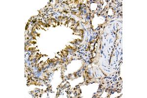 Immunohistochemistry of paraffin-embedded rat lung using ERK1/2 Rabbit mAb (ABIN7268620) at dilution of 1:100 (40x lens). (ERK1 antibody)