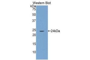 Western Blotting (WB) image for anti-Glutamate Receptor Interacting Protein 1 (GRIP1) (AA 79-268) antibody (ABIN1859070) (GRIP1 antibody  (AA 79-268))