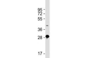 Western blot testing of human skeletal muscle lysate with DNASE1L2 antibody at 1:2000. (DNASE1L2 antibody  (AA 199-229))