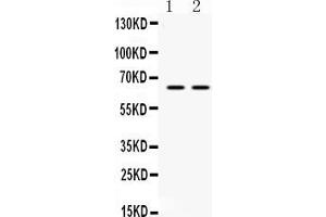 Western blot analysis of HnRNP L expression in PANC whole cell lysates ( Lane 1) and JURKAT whole cell lysates ( Lane 2).