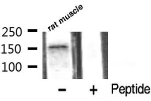 Western blot analysis of VEGFR2 phosphorylation expression in rat muscle tissue lysates,The lane on the right is treated with the antigen-specific peptide. (VEGFR2/CD309 antibody  (pTyr1059))