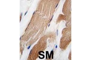 Formalin-fixed and paraffin-embedded human skeletal muscle tissue reacted with ILK Antibody  f antibody, which was peroxidase-conjugated to the secondary antibody, followed by DAB staining. (ILK antibody  (AA 151-180))
