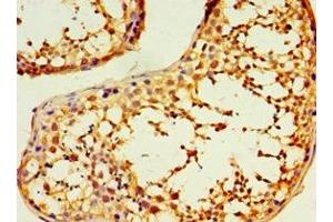 Immunohistochemistry of paraffin-embedded human testis tissue using ABIN7150881 at dilution of 1:100 (DNAL1 antibody  (AA 41-190))