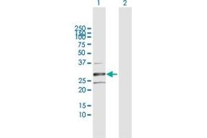 Western Blot analysis of HSD17B8 expression in transfected 293T cell line by HSD17B8 MaxPab polyclonal antibody. (HSD17B8 antibody  (AA 1-261))