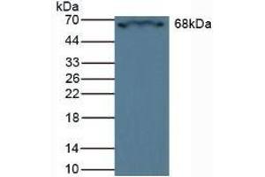Detection of CRAT in Rat Heart Tissue using Polyclonal Antibody to Carnitine Acetyltransferase (CRAT) (CRAT antibody  (AA 55-256))