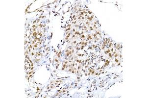 Immunohistochemistry (IHC) image for anti-Interleukin 6 Signal Transducer (Gp130, Oncostatin M Receptor) (IL6ST) (AA 678-857) antibody (ABIN7268004)