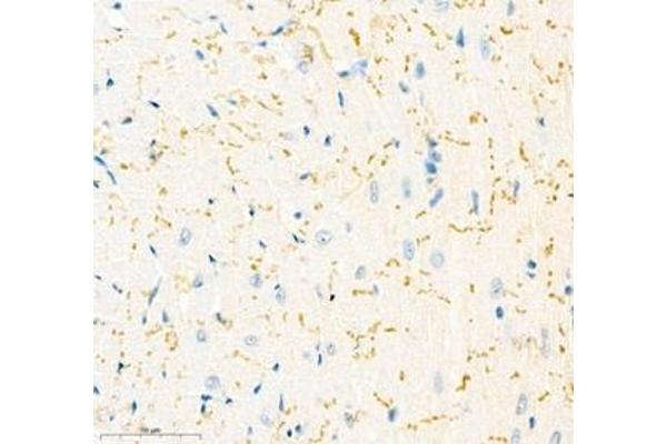 IL-34 antibody