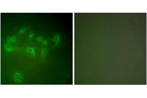 Immunofluorescence analysis of A549 cells, using MDM2 Antibody. (MDM2 antibody  (AA 391-440))