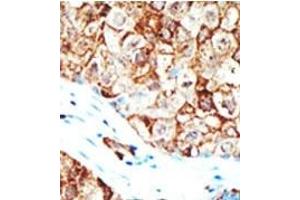 Image no. 2 for anti-Ubiquilin 1 (UBQLN1) (Middle Region) antibody (ABIN357612) (Ubiquilin 1 antibody  (Middle Region))