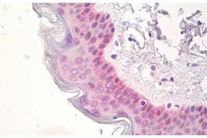 Image no. 2 for anti-SRY (Sex Determining Region Y)-Box 2 (SOX2) (AA 100-150) antibody (ABIN1490795) (SOX2 antibody  (AA 100-150))
