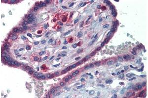 Human Placenta (formalin-fixed, paraffin-embedded) stained with GATA6 antibody ABIN462170 followed by biotinylated goat anti-rabbit IgG secondary antibody ABIN481713, alkaline phosphatase-streptavidin and chromogen. (GATA6 antibody  (C-Term))