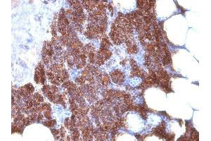 Formalin-fixed, paraffin-embedded human Parathyroid stained with PTH Monoclonal Antibody (3H9 + PTH/1175). (PTH antibody  (AA 1-34, AA 32-115))