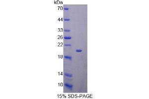 SDS-PAGE analysis of Mouse KLRK1 Protein.