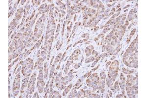 IHC-P Image Immunohistochemical analysis of paraffin-embedded A549 xenograft, using p40 , antibody at 1:100 dilution. (RABEPK antibody)