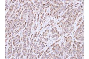 IHC-P Image Immunohistochemical analysis of paraffin-embedded A549 xenograft, using p40 , antibody at 1:100 dilution. (RABEPK antibody)