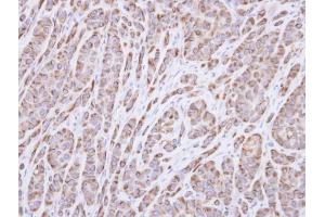 IHC-P Image Immunohistochemical analysis of paraffin-embedded A549 xenograft, using p40 , antibody at 1:100 dilution.